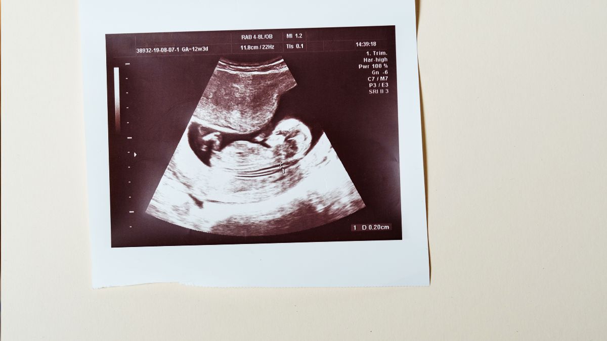 sonogram