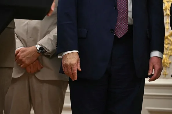 A close-up of President Donald Trump's hands during an event in the Oval Office.