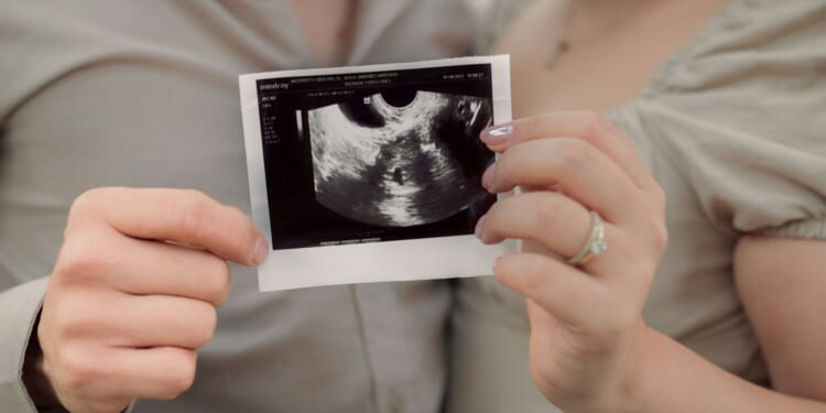 Medical Industry Doesn't Want You To Know About IVF Alternatives