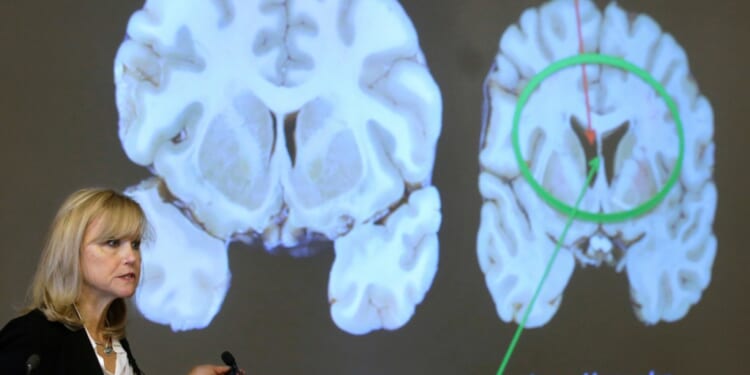 Shooter who targeted NFL headquarters diagnosed with CTE after death