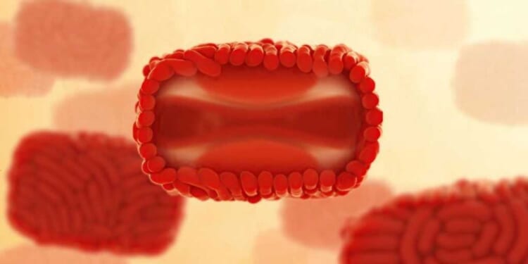 Gay-spread monkeypox is back. Watchdog asks policymakers to drop the political correctness.