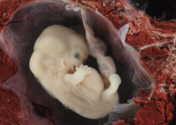 80 Years After Nuremberg Trials, Doctors Still Commit Atrocities