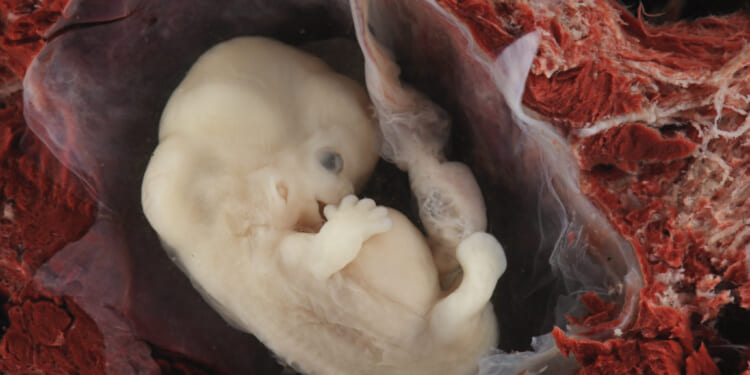 80 Years After Nuremberg Trials, Doctors Still Commit Atrocities