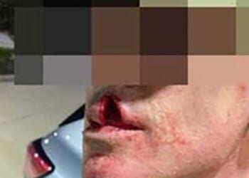 Illegal alien pedophile allegedly 'physically assaulted' ICE agent during immigration operation: DHS