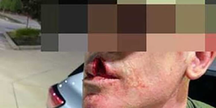 Illegal alien pedophile allegedly 'physically assaulted' ICE agent during immigration operation: DHS