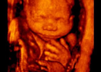 North Dakota Supreme Court overturns lower court judge: Pro-life ban reinstated after leftist attempt to block law