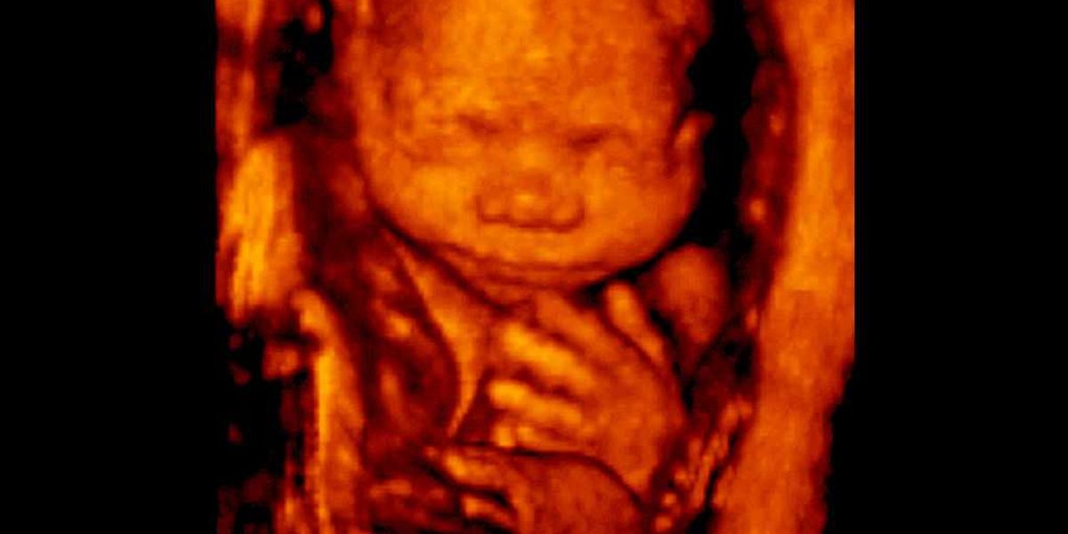 North Dakota Supreme Court overturns lower court judge: Pro-life ban reinstated after leftist attempt to block law