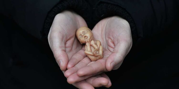 Why the pro-life movement fails without a Christian worldview