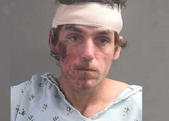 Homeless man allegedly choked 13-year-old at school bus stop until Good Samaritan beat his face with a toolbox