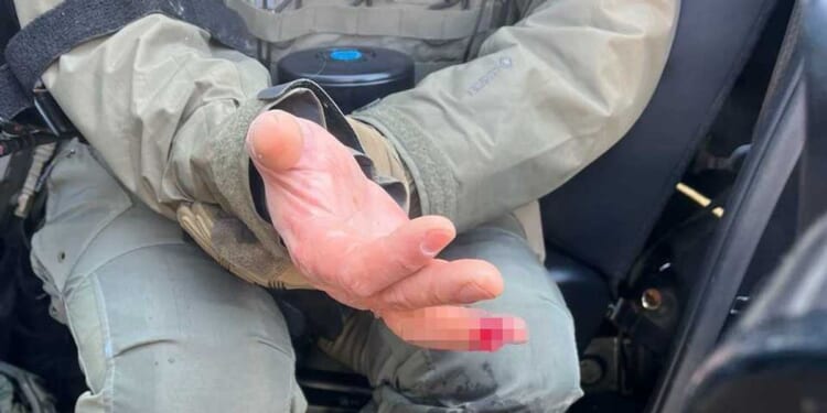 Rioter bit off part of federal agent's finger amid Minneapolis 'rampant assault,' DHS says