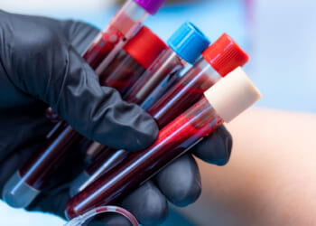 Congress Can Change the Cancer Story with a Vote