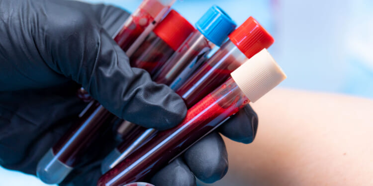 Congress Can Change the Cancer Story with a Vote