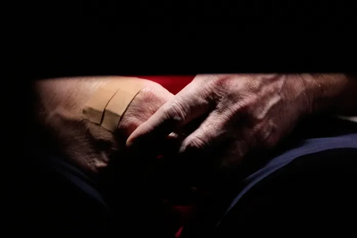 President Donald Trump's hands, one covered with a Band-Aid