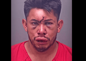 13-year-old boy brutally punishes stepfather who allegedly strangled his mom and also attacked him