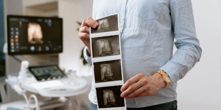 woman holding ultrasound photos